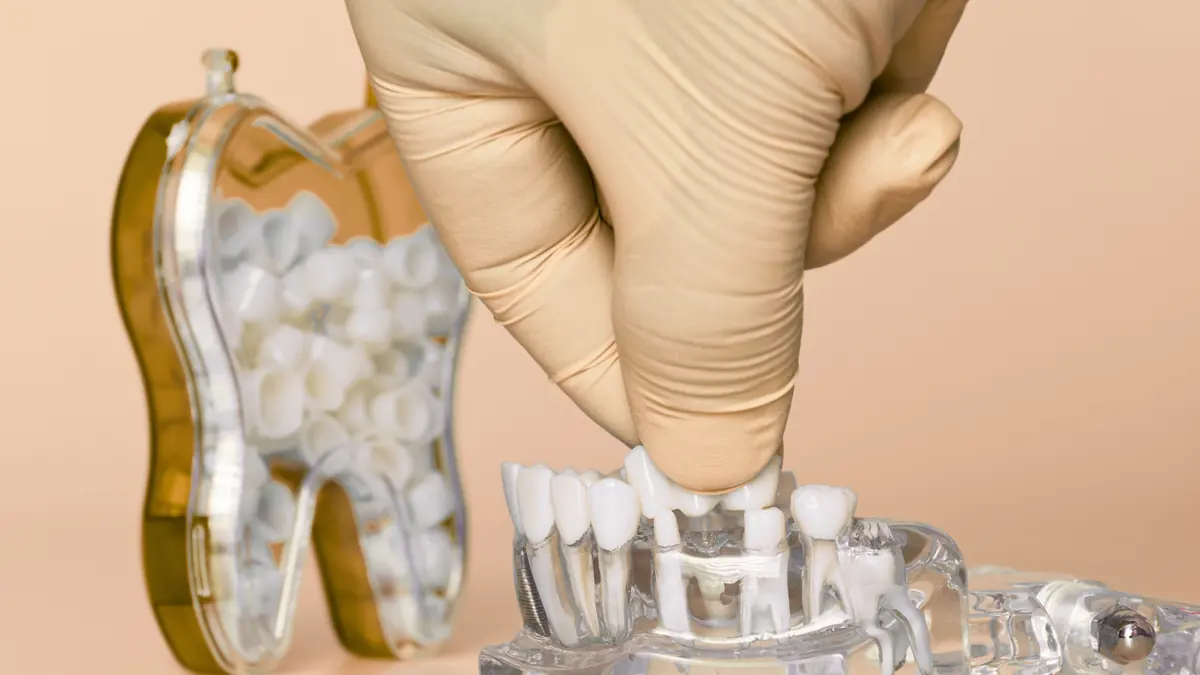 Gloved hand placing a dental bridge on a tooth model