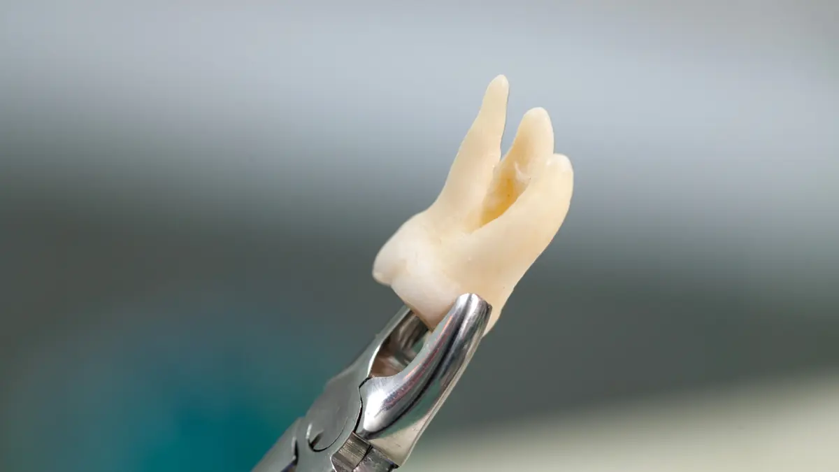 Extracted tooth held by dental forceps
