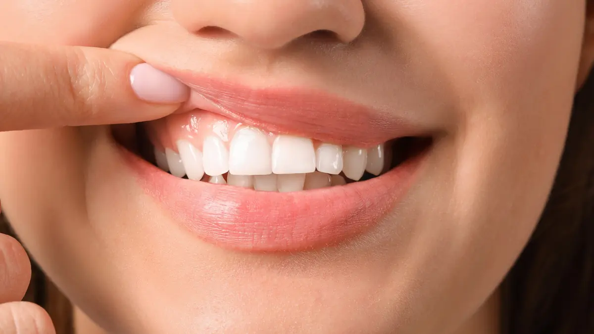Smiling person lifting the lip to show healthy gums